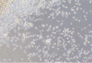 S’pore to trial using healthy donors’ white blood cells primed to seek out and kill cancer cells